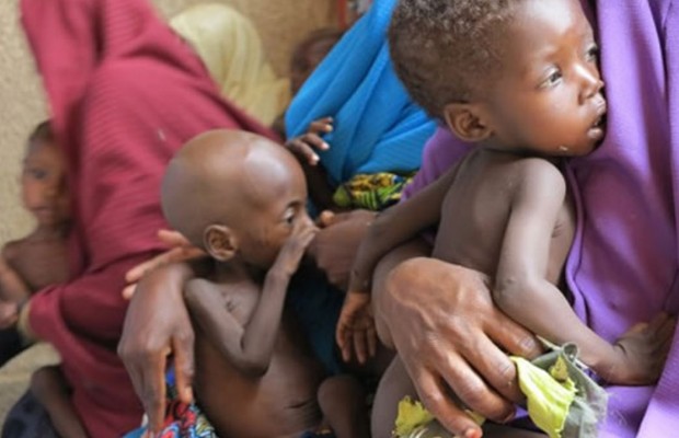 Experts bemoan malnutrition rate in Kano