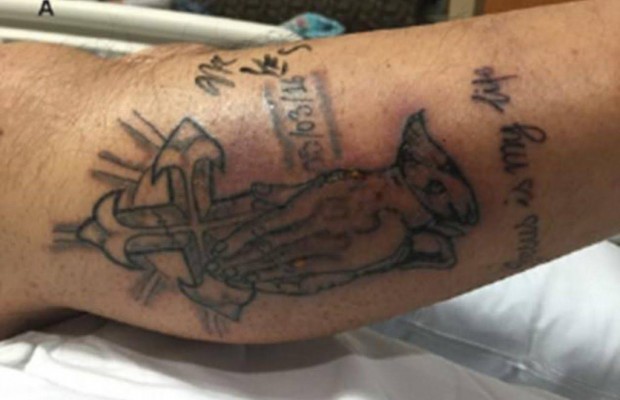 Man dies after defaulting tattoo warnings