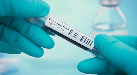 Third Case of Coronavirus (COVID - 19) Confirmed in Lagos