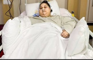 World fattest woman looses 323kg