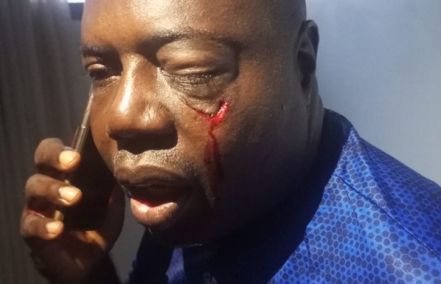 Hoodlums Attack Chairman Oyo State Sports Council, Ibadan