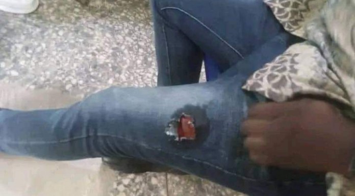 Journalist, One Other Shot by Police in Osun